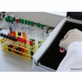 METOT VALİDASYONU VE ÖLÇÜM BELİRSİZLİĞİ EĞİTİMİ