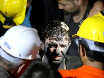 TÜM TÜRKİYENİN BAŞISAĞOLSUN!!